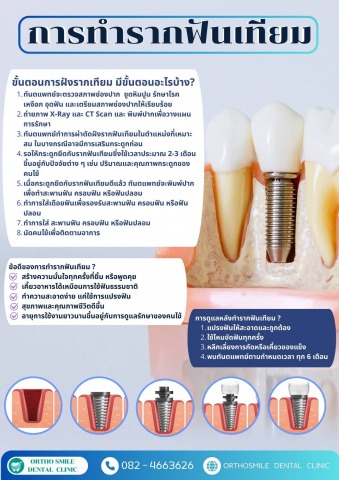 คลินิกรักษารากฟันเทียม คลอง 3